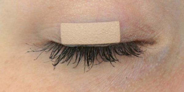 Oculid External Eyelid Weight